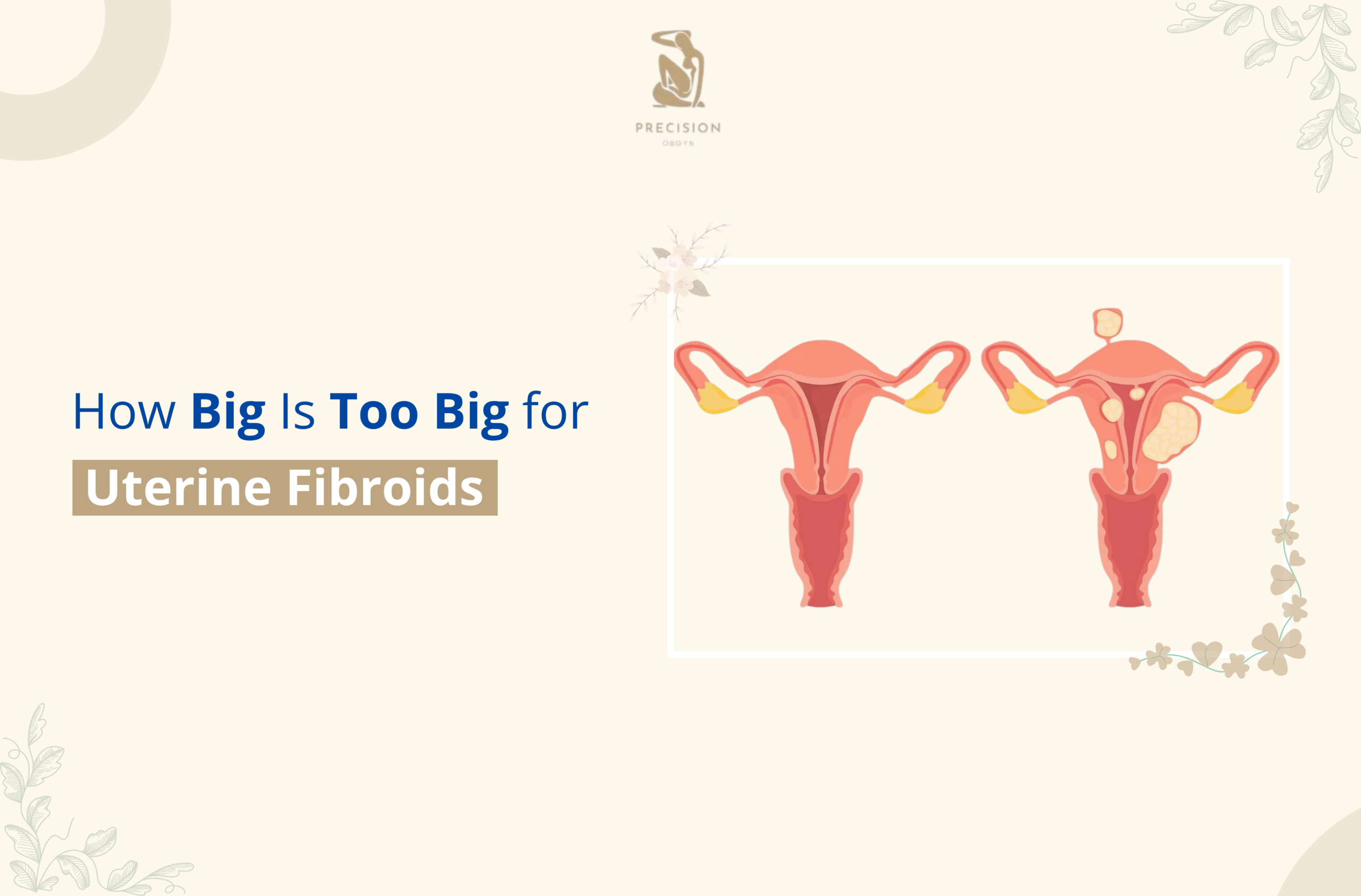 How Big Is Too Big for Uterine Fibroids