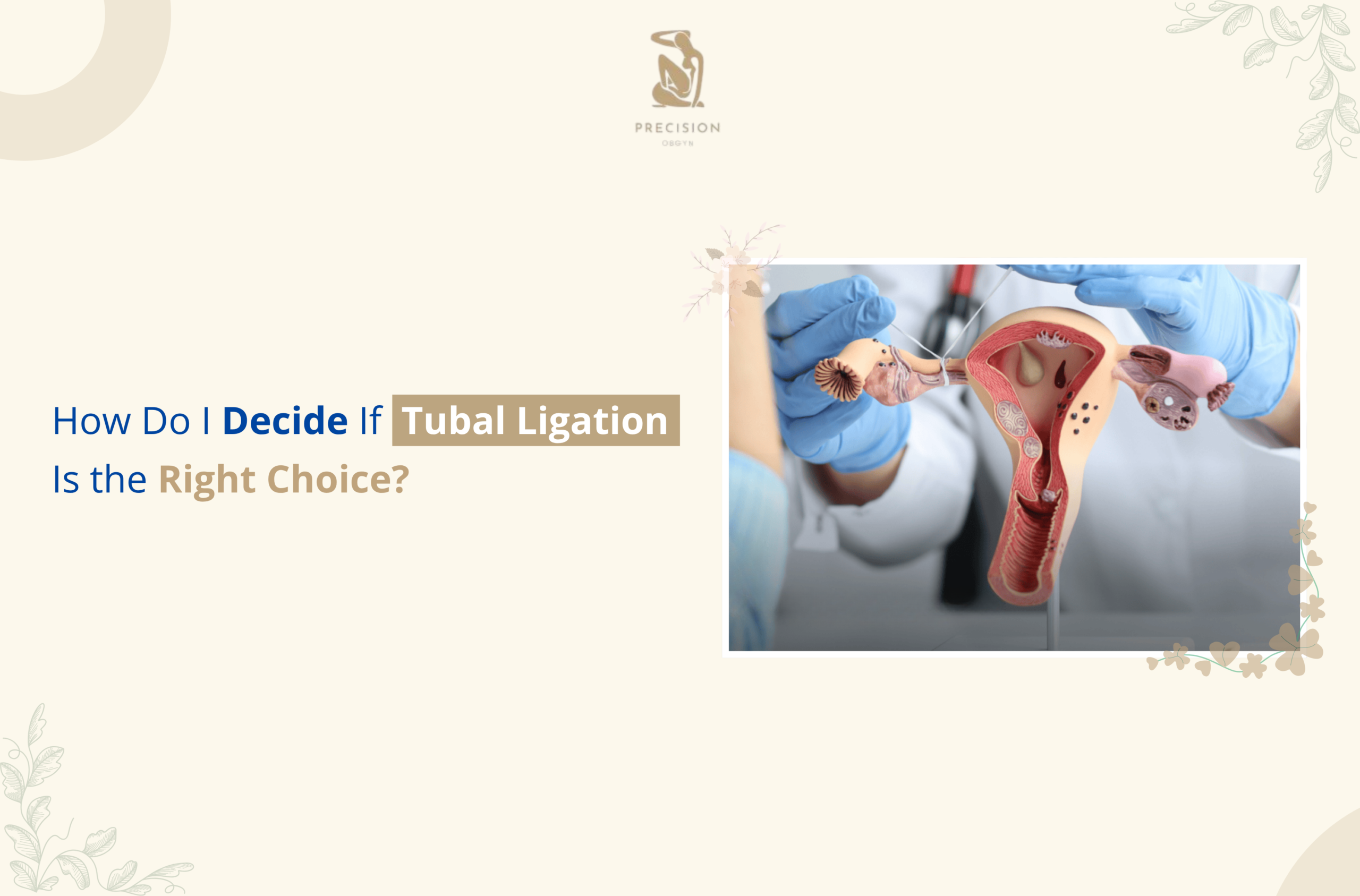 How Do I Decide If Tubal Ligation Is the Right Choice